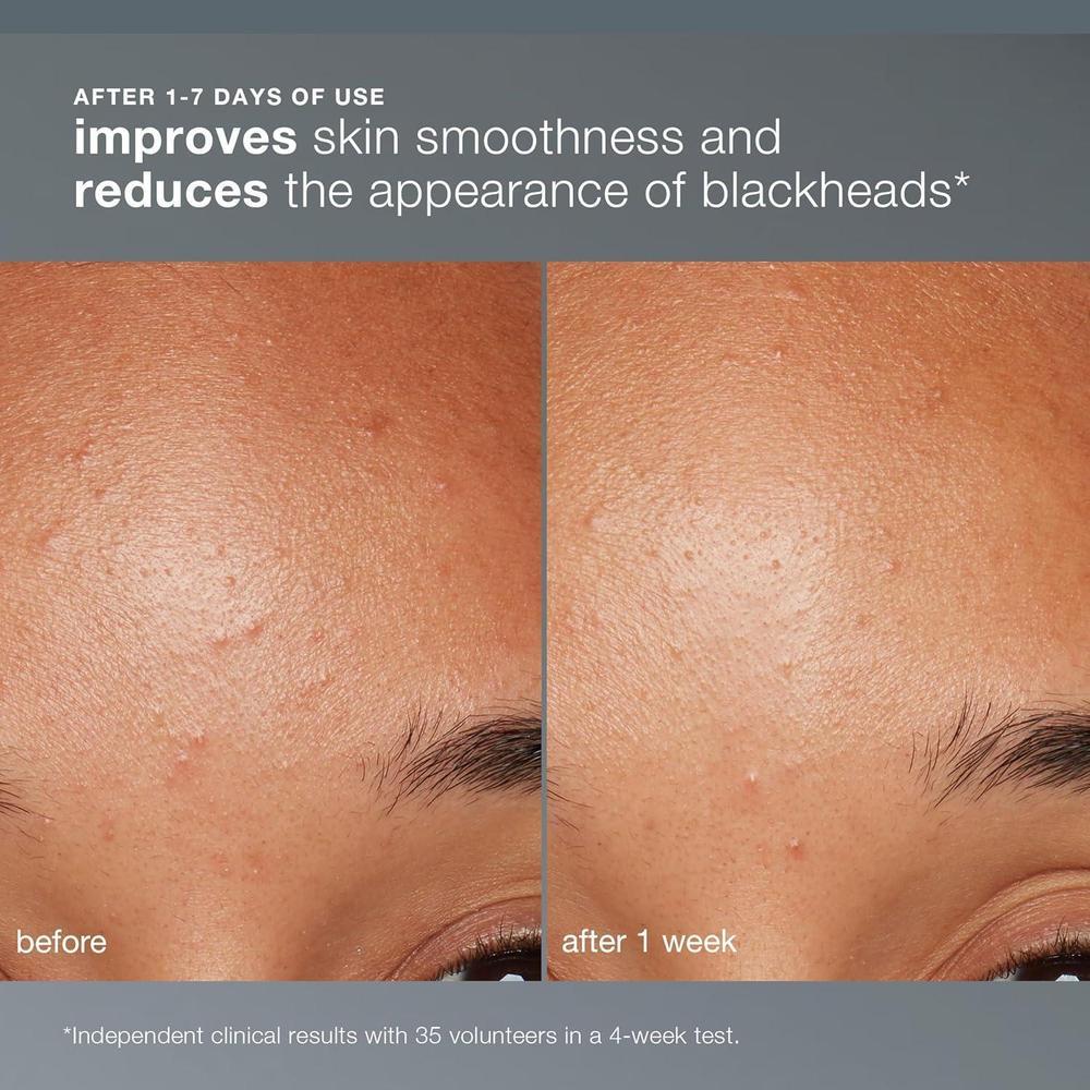 Dermalogica Exfoliante Facial Polvo Con Ácido Salicílico Y Papaya 13g