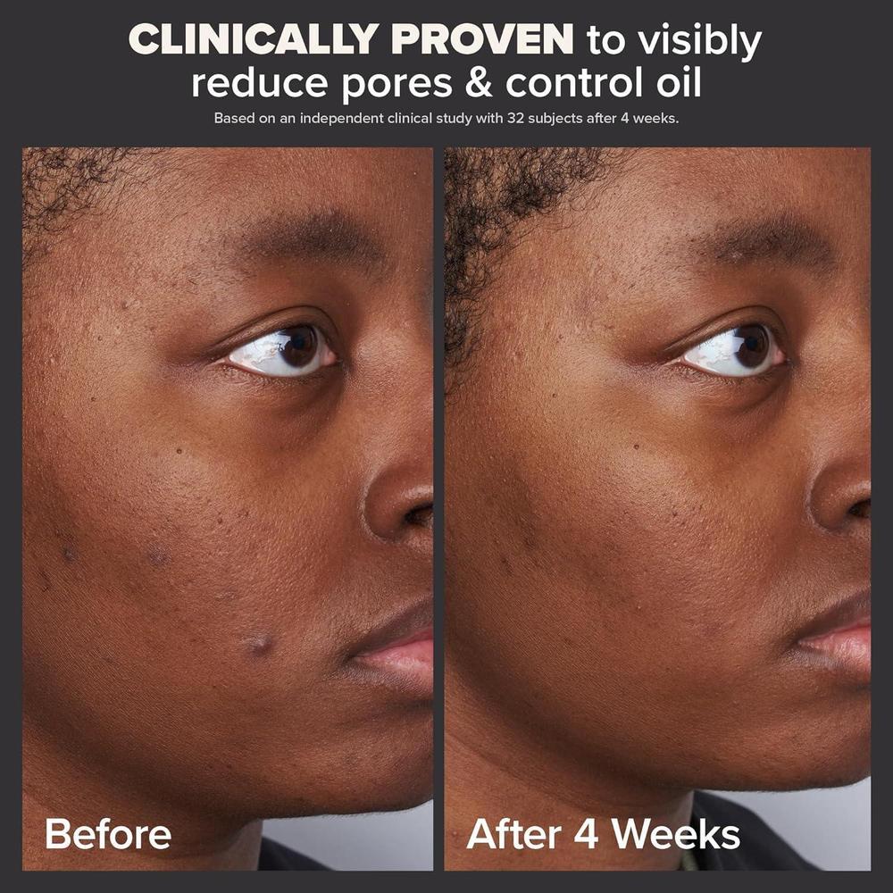 Perfeccionador De Piel Paula's Choice 2% BHA Ácido Salicílico, Exfoliante Líquido Para Puntos Negros Y Poros Abiertos, 118 Ml