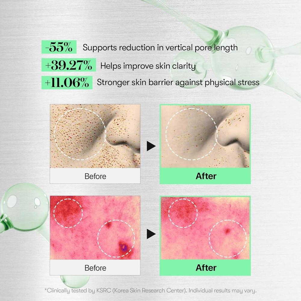 Vt Cosmetics Suero Microneedling Cica Reedle Shot 100 Exfoliación Poros 50ml