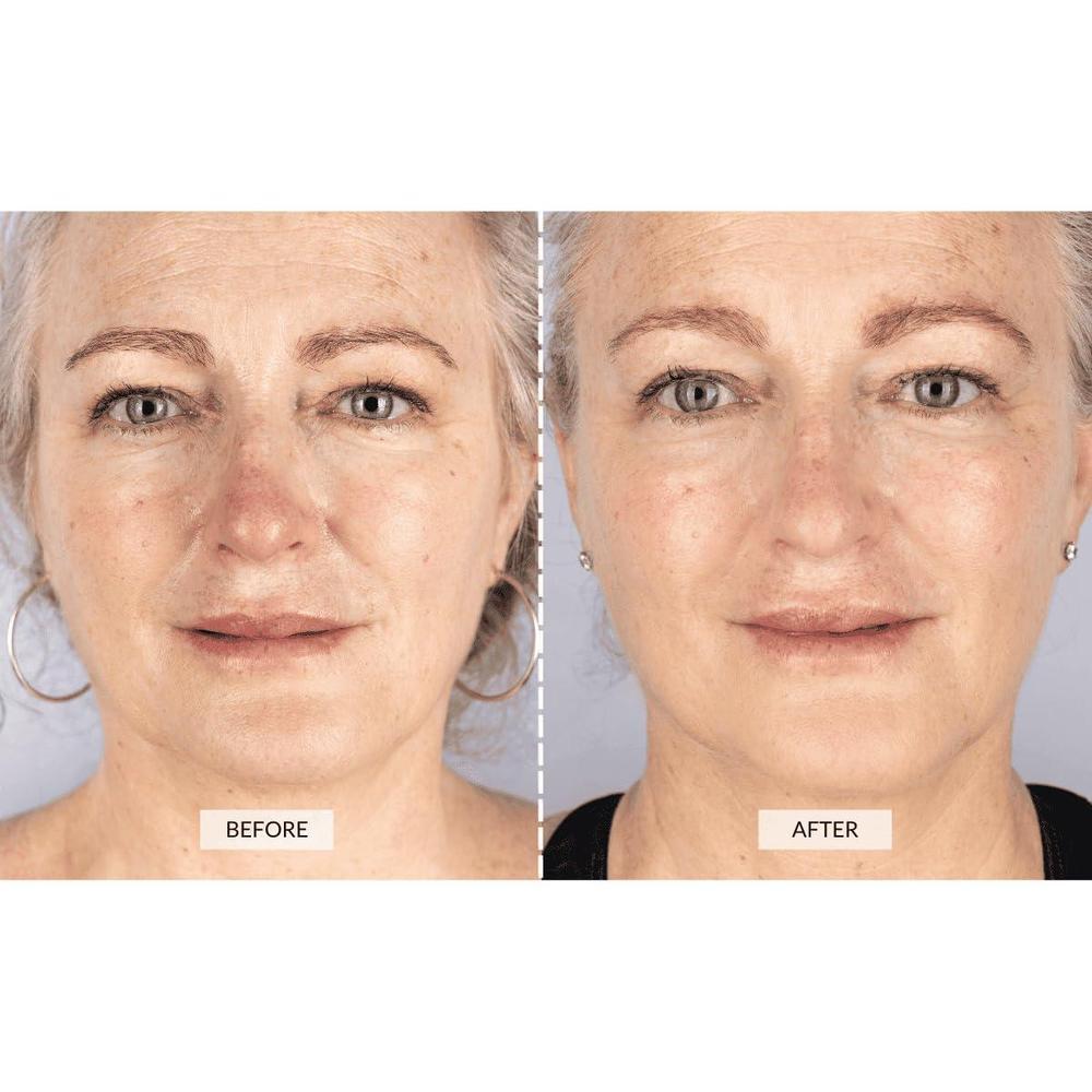 Máscara Facial LED de Terapia de Luz CurrentBody para Rejuvenecimiento y Reducción de Arrugas