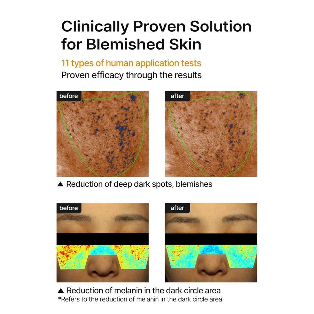 Crema Celimax Hidratante Para Manchas Oscuras Con Niacinamida Y Ácido Tranexámico 35ml