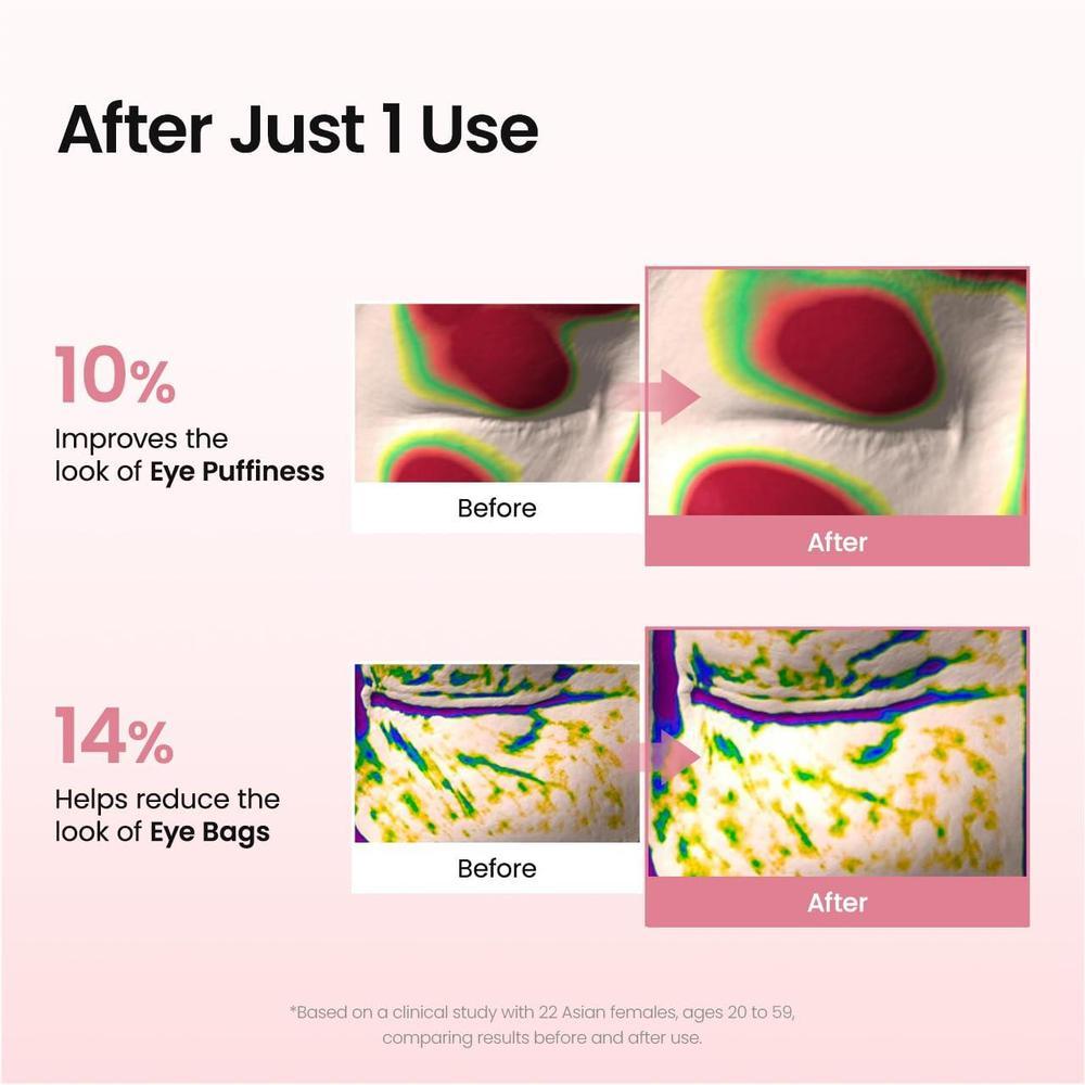 Parches De Péptido De Colágeno Biodance Para Reducir Arrugas Y Líneas Finas En Ojos