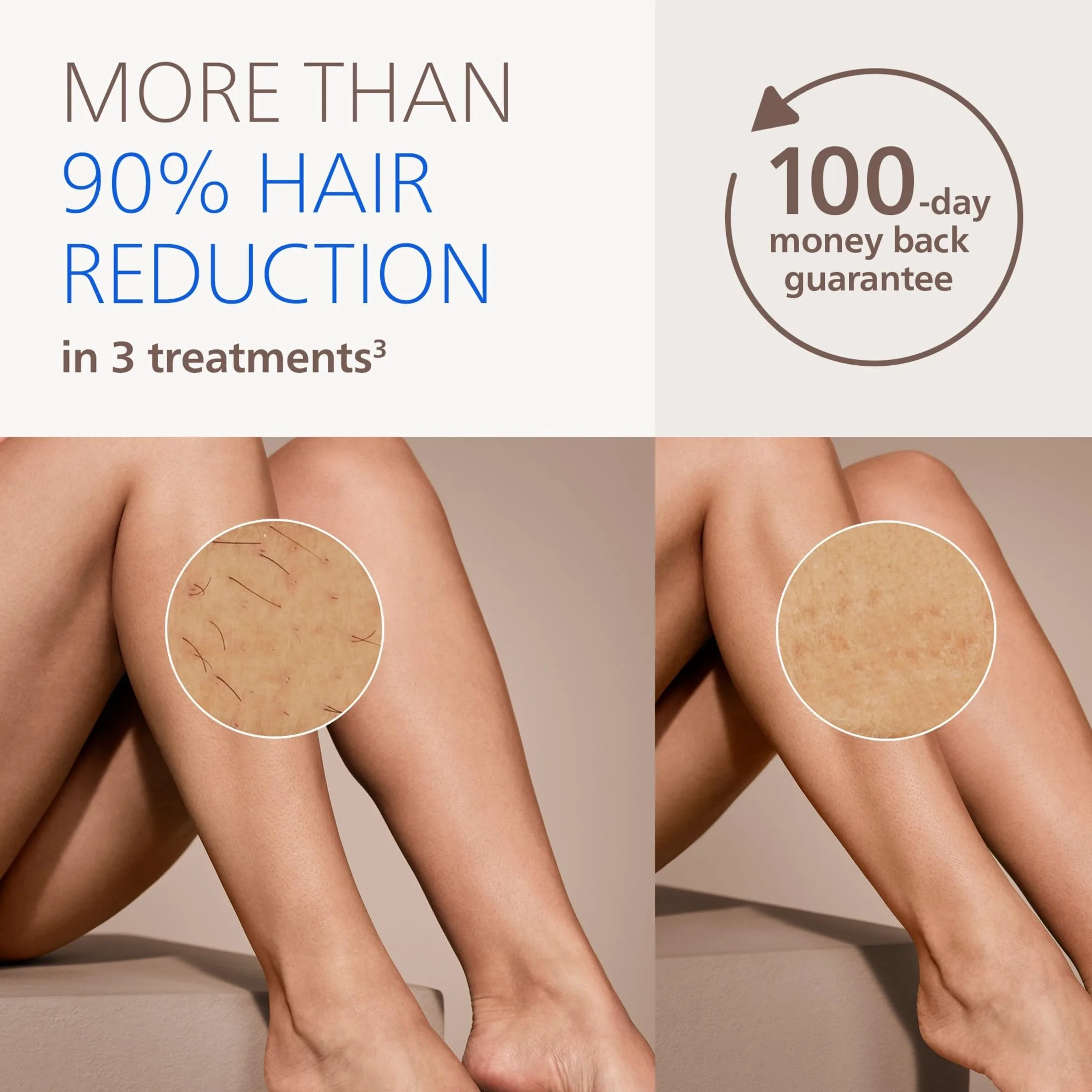 Philips Lumea 7000 Series IPL Hair Removal Device, Permanent Laser Hair Reduction for Women & Men, Easy and Comfortable Use at Home, SenseIQ, Uniquely Curved Attachment for Body, BRI931/03