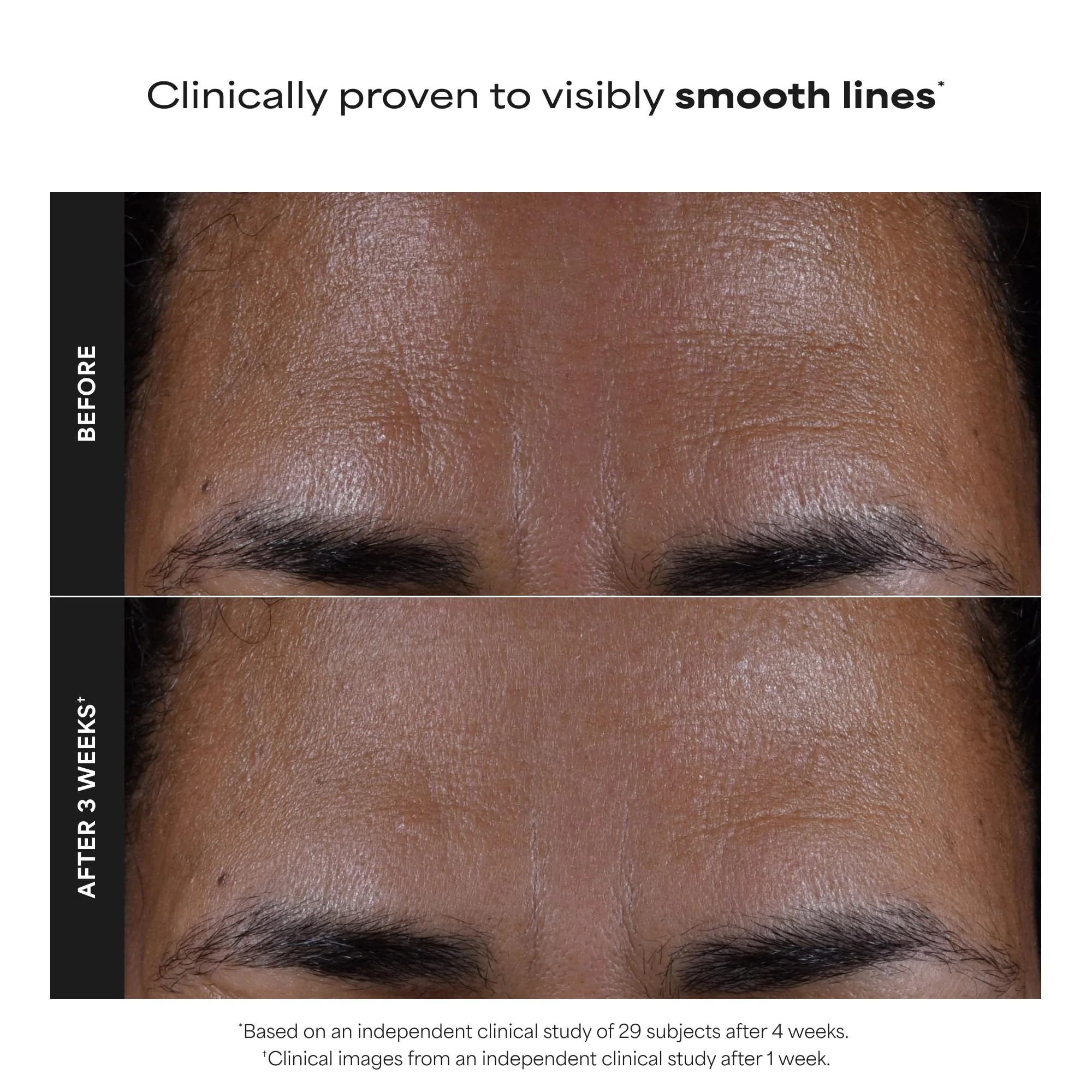 Paula's Choice SKIN PERFECTING 2% BHA Liquid Salicylic Acid Exfoliant-Facial Exfoliant for Blackheads, Enlarged Pores, Wrinkles & Fine Lines